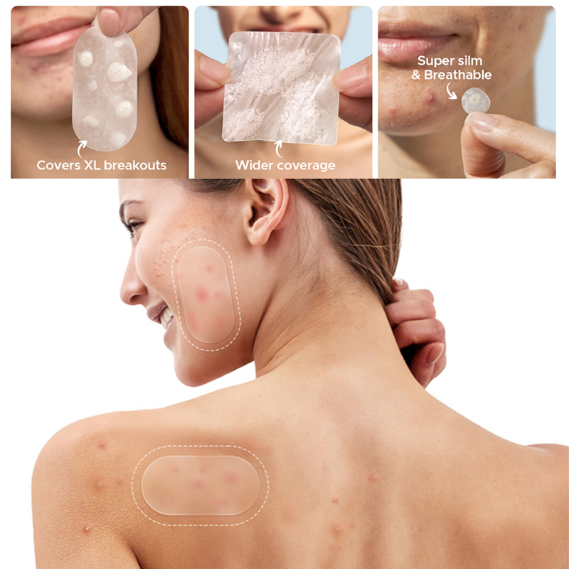 New 116Pcs Invisible Anti-Acne - đánh giá và giá Beauty And Makeup