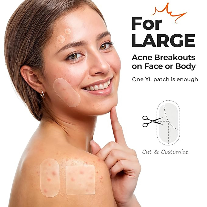 New 116Pcs Invisible Anti-Acne - đánh giá và giá Beauty And Makeup